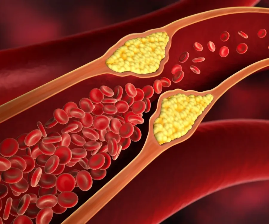 good diet plan for high cholesterol